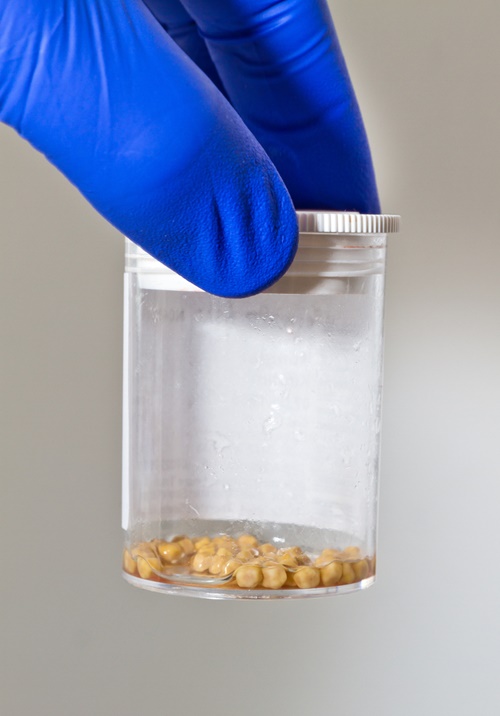 นิ่วในถุงน้ำดี